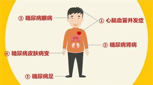 糖尿病的并发症有哪些