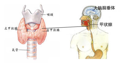 甲状腺炎复发的原因是什么