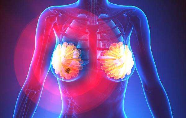 乳腺增生的症状类型及治疗方法