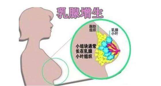 患上乳腺增生的原因有哪些