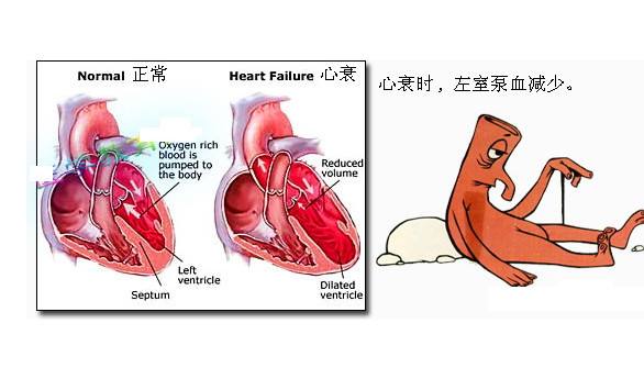 心力衰竭的致病原因是什么