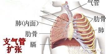 造成支气管扩张的原因有哪些