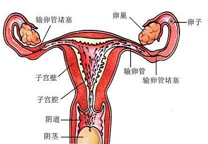 输卵管堵塞的危害有哪些