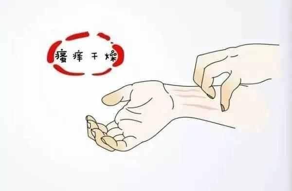 什么是湿疹?湿疹的病因有哪些?