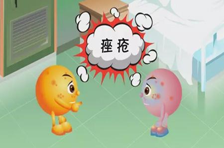 痤疮是由什么原因引起的