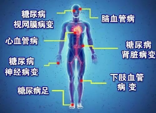 糖尿病早期会出现这些异常症状，不要忽视!