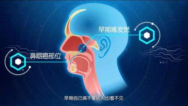 鼻咽癌的诱发原因需知?