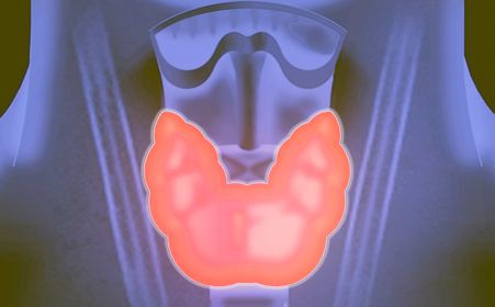 甲状腺癌的治疗方法和类型分析?