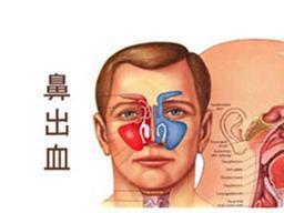 鼻咽癌治疗后复发的可能大吗?