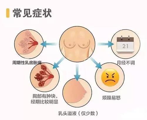 乳腺增生会癌变吗?乳腺增生有哪些症状？