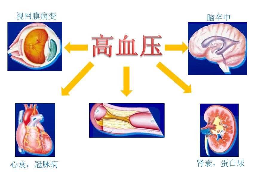 长期高血压会出现哪些并发症？