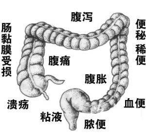 十二指肠炎病的症状以及治疗?