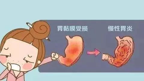 反复出现这4种症状，说明你已经患上了慢性胃炎